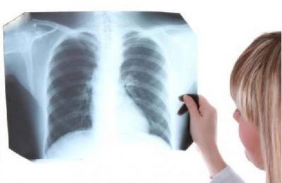 Туберкулёз: можно ли вылечиться и как не заболеть?