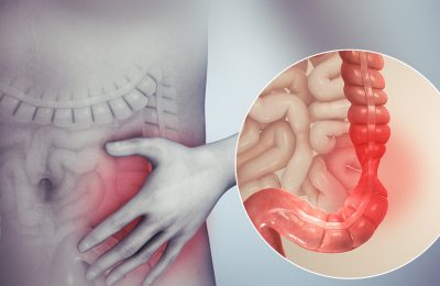 Когда кишечник не болеет, но болит