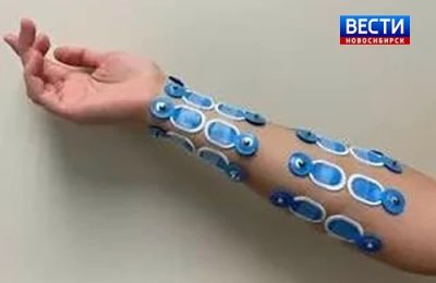 Нговосибирские студенты-медики разработали прототип бионического протеза руки